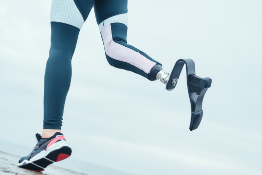 Illustration of the legs of a female athlete wearing a prosthetic foot on her right leg.