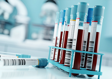 Blutproben: VOCs in der Diagnostik